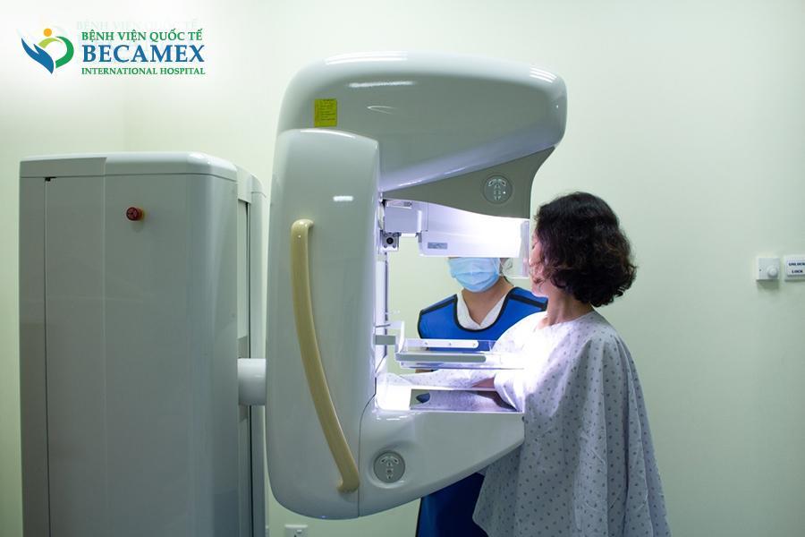 Vai trò của chụp nhũ ảnh trong tầm soát ung thư vú