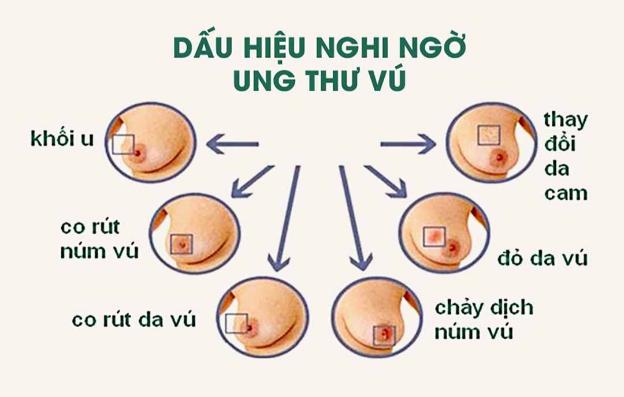 10 biện pháp giúp giảm nguy cơ ung thư vú